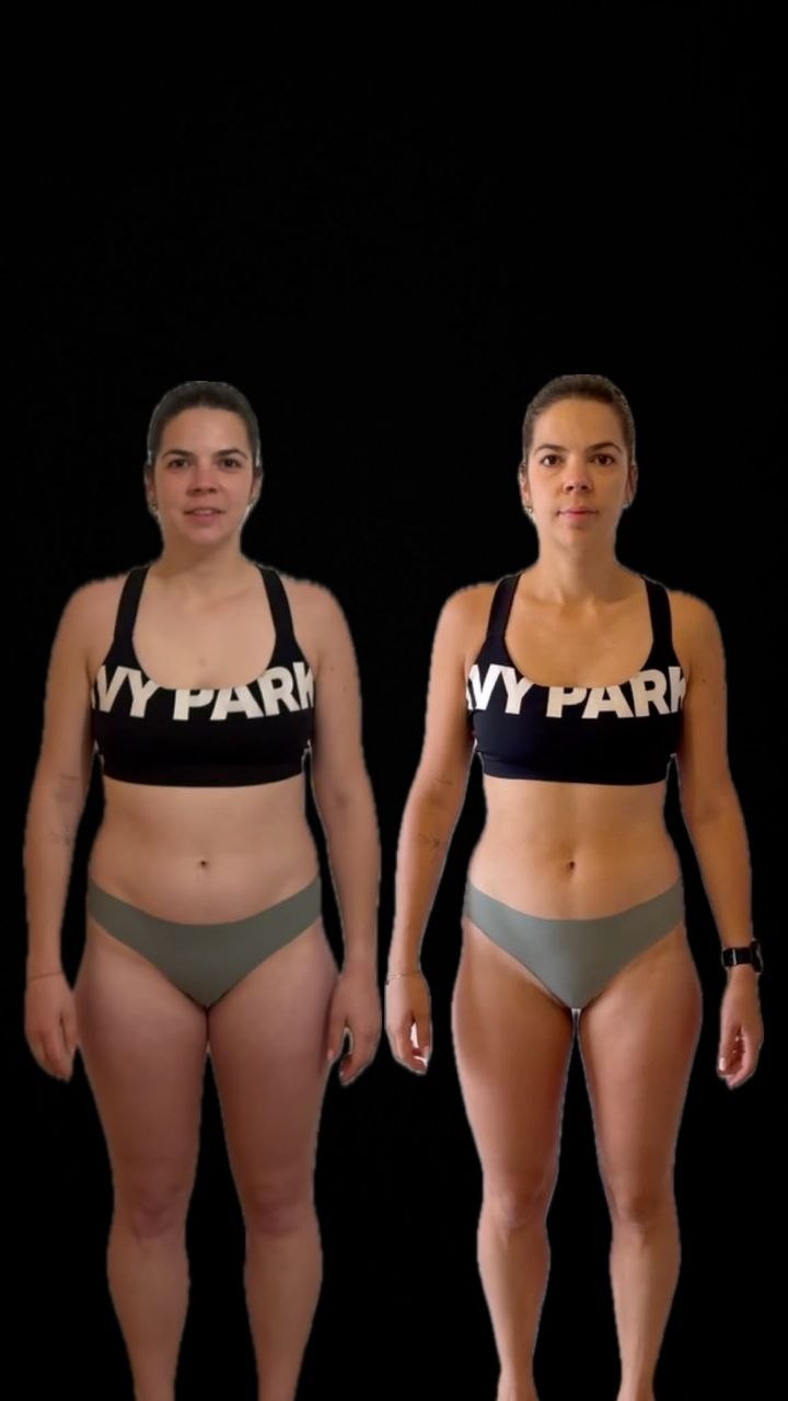 Avant / après — Émeline, 34 ans